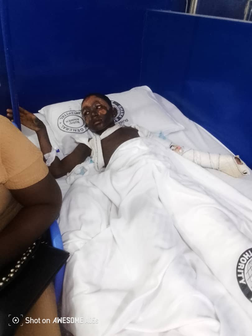 Mother and children suffer severe burns, appeal for support for life-saving treatment